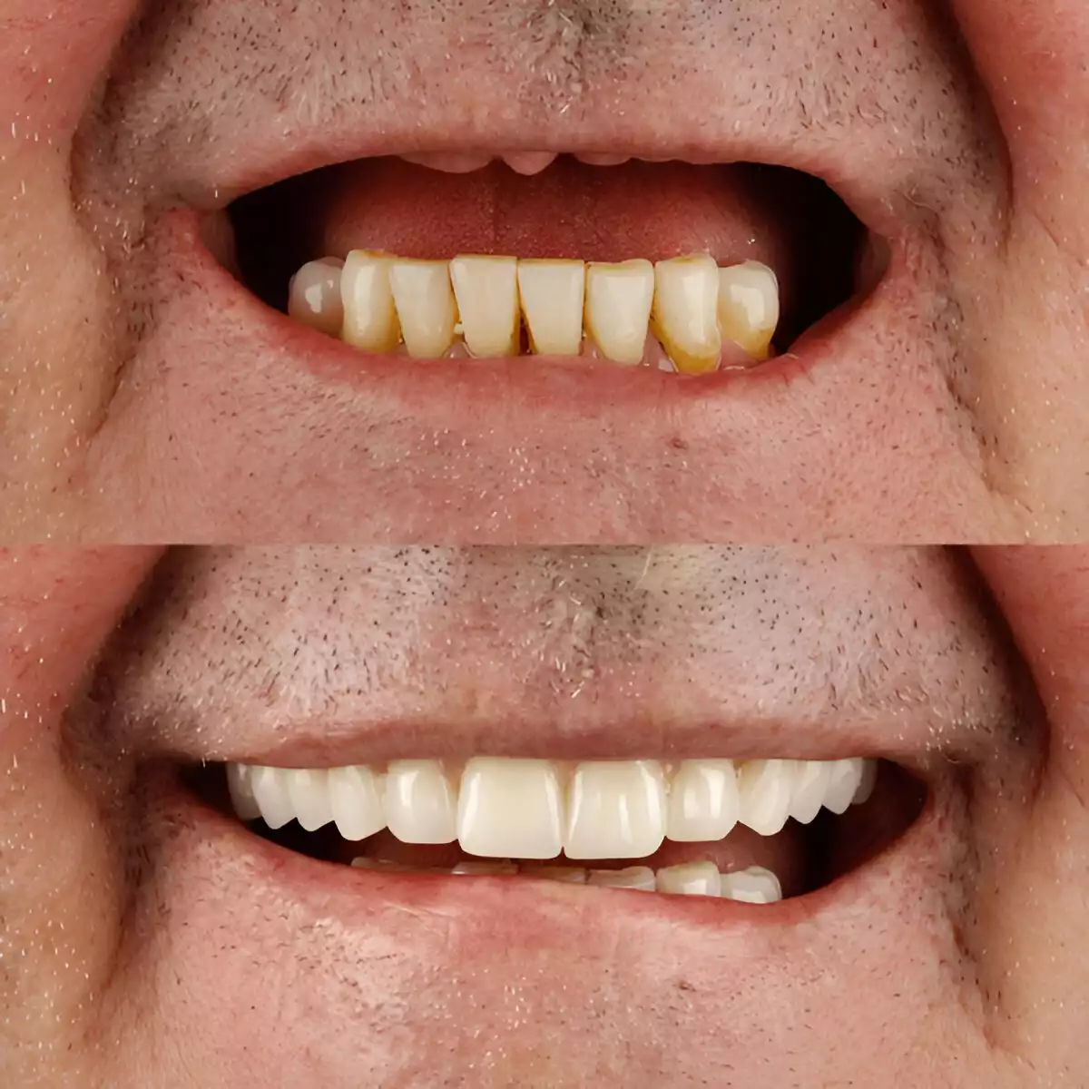 Especialista em Implante Dentário